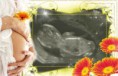/album/ine/pregnancy-10jui-5p8-print-jpg/